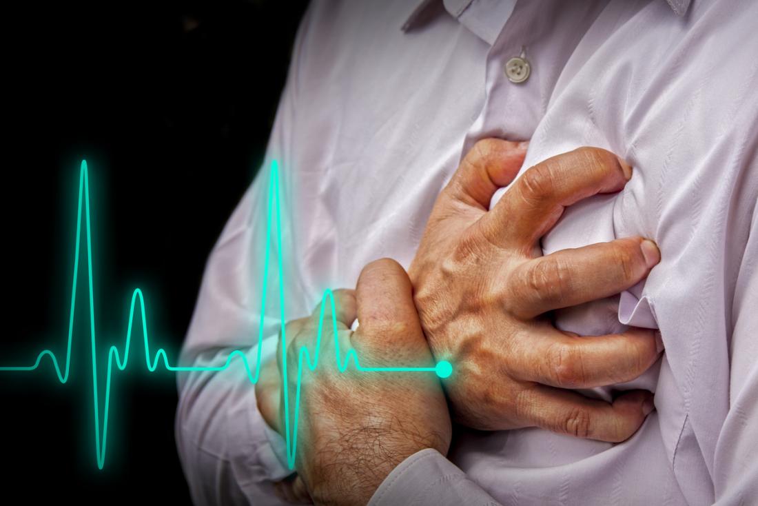 Несемейните мъже с болни сърца живеят по краткоНово изследване показва че
