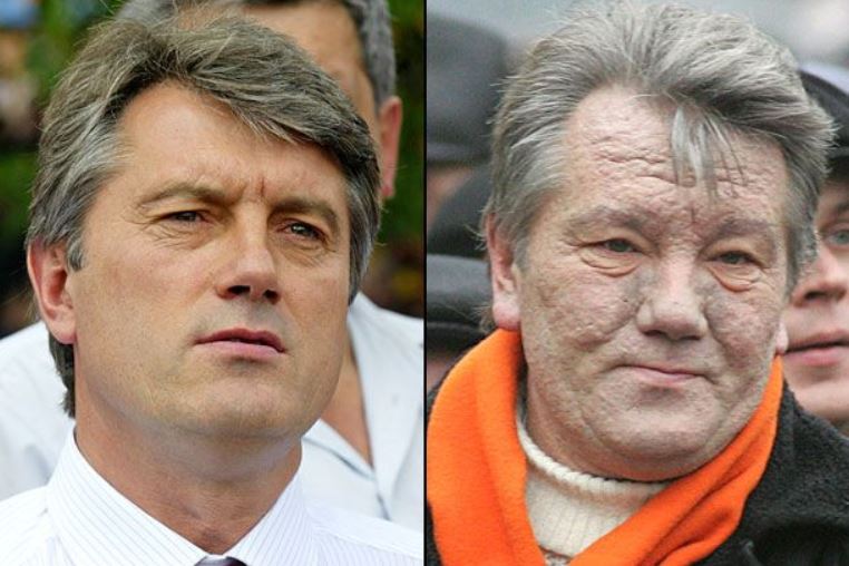 Виктор Юшченко преди и след отравянето с диоксин