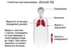 коронавирус, симптоми