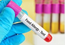 тест алергии