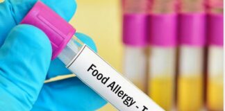 тест алергии