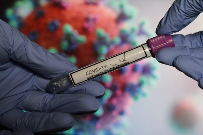 4626 са новите случаи на коронавирус у нас при направени