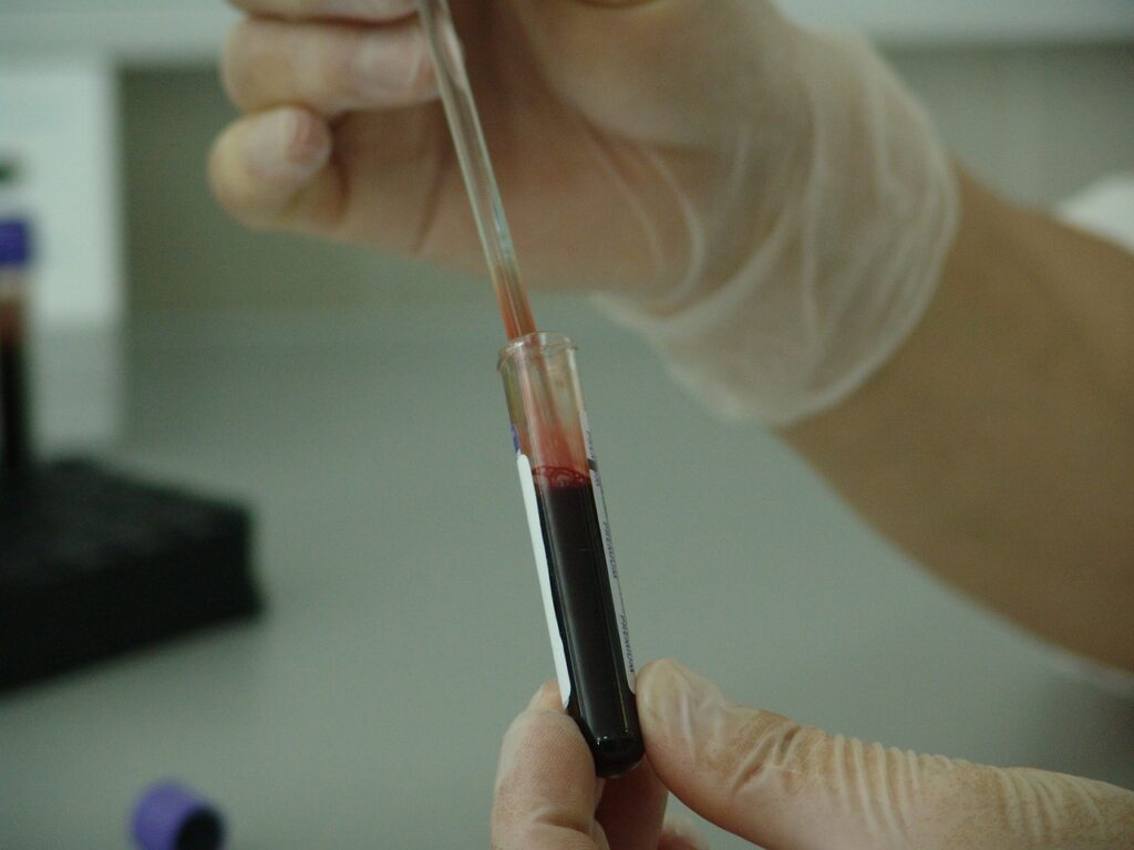 кръвен тест, лаборатория