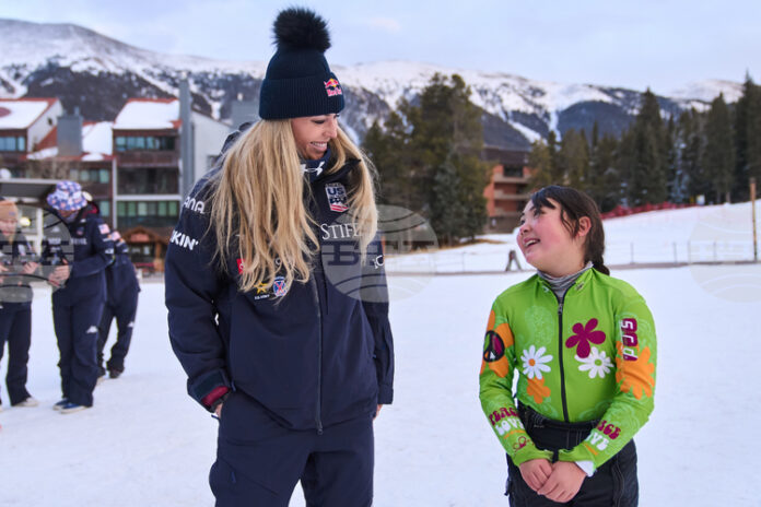 Линдзи Вон издирва изгубена щека с публикация в социалните мрежи